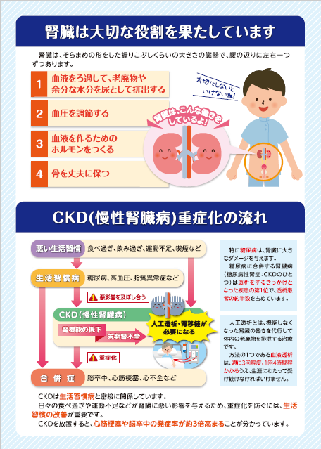 CKD２