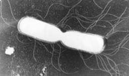 セレウス菌の電子顕微鏡写真