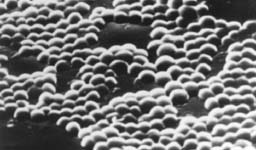 黄色ブドウ球菌の電子顕微鏡写真