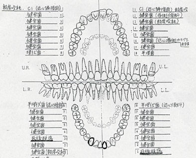 デンタルチャート