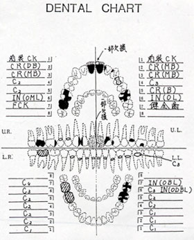 デンタルチャート